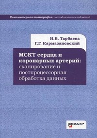 МСКТ сердца и коронарных артерий