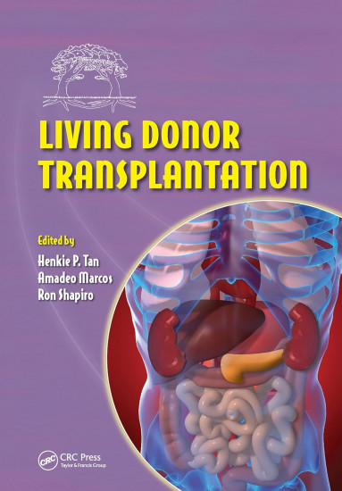 Living Donor Organ Transplantation