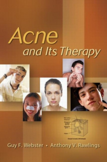 Acne And Its Therapy