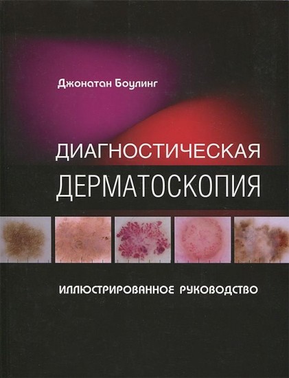 Диагностическая дерматоскопия. Иллюстрированное руководство