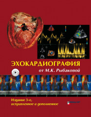 Эхокардиография от Рыбаковой