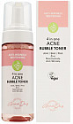Тонер для лица пузырьковый «4 in one acne bubble toner»