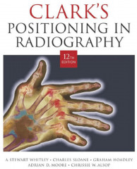 Clark's Positioning in Radiography