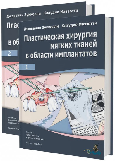 Пластическая хирургия мягких тканей в области имплантатов