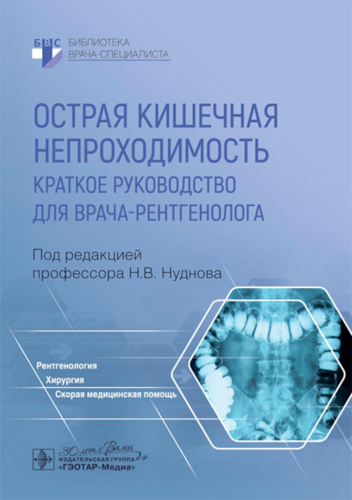 Острая кишечная непроходимость. Краткое руководство для врача-рентгенолога | Библиотека врача-специалиста