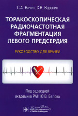 Торакоскопическая радиочастотная фрагментация левого предсердия