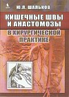 Кишечные швы и анастомозы в хирургической практике