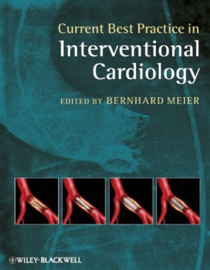 Current Best Practice in Interventional Cardiology