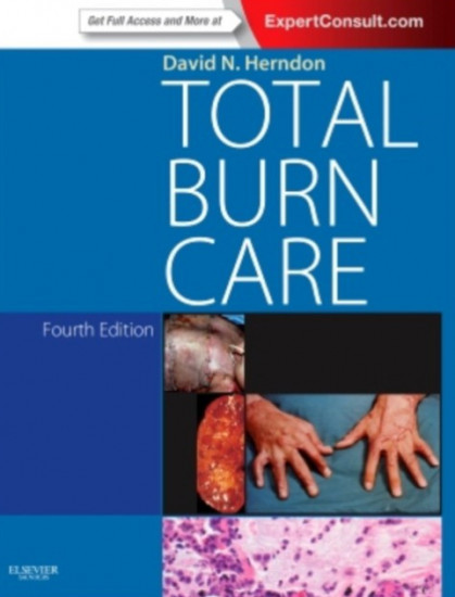 Total Burn Care