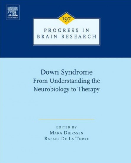 Down Syndrome. From Understanding
