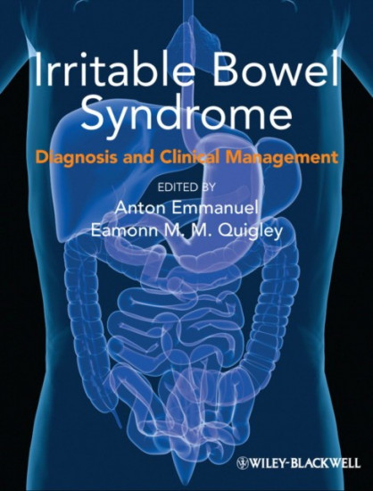 Irritable Bowel Syndrome. Diagnosis