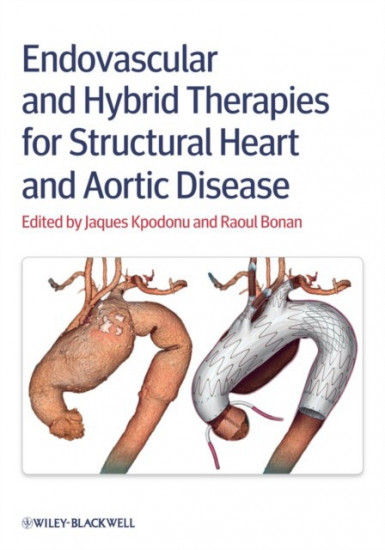 Endovascular and Hybrid Therapies