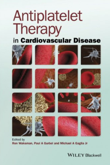 Antiplatelet Therapy in Cardiovascular Disease