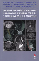 Магнитно-резонансная томография