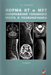 Норма КТ- и МРТ- изображений головного мозга и позвоночника