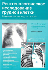 Рентгенологическое исследование грудной клетки