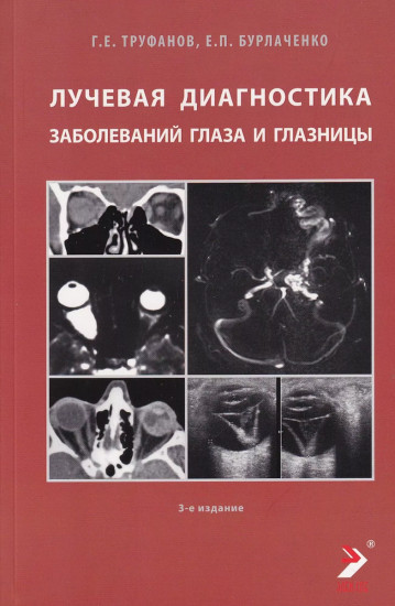 Лучевая диагностика заболеваний глаза и глазницы