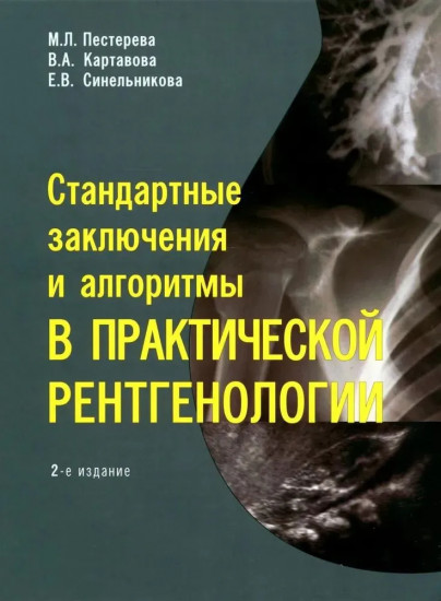 Стандартные заключения и алгоритмы