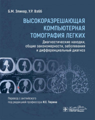 Высокоразрешающая компьютерная томография легких