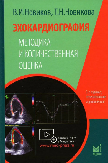 Эхокардиография