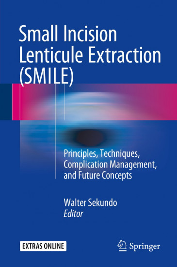 Small Incision Lenticule Extraction