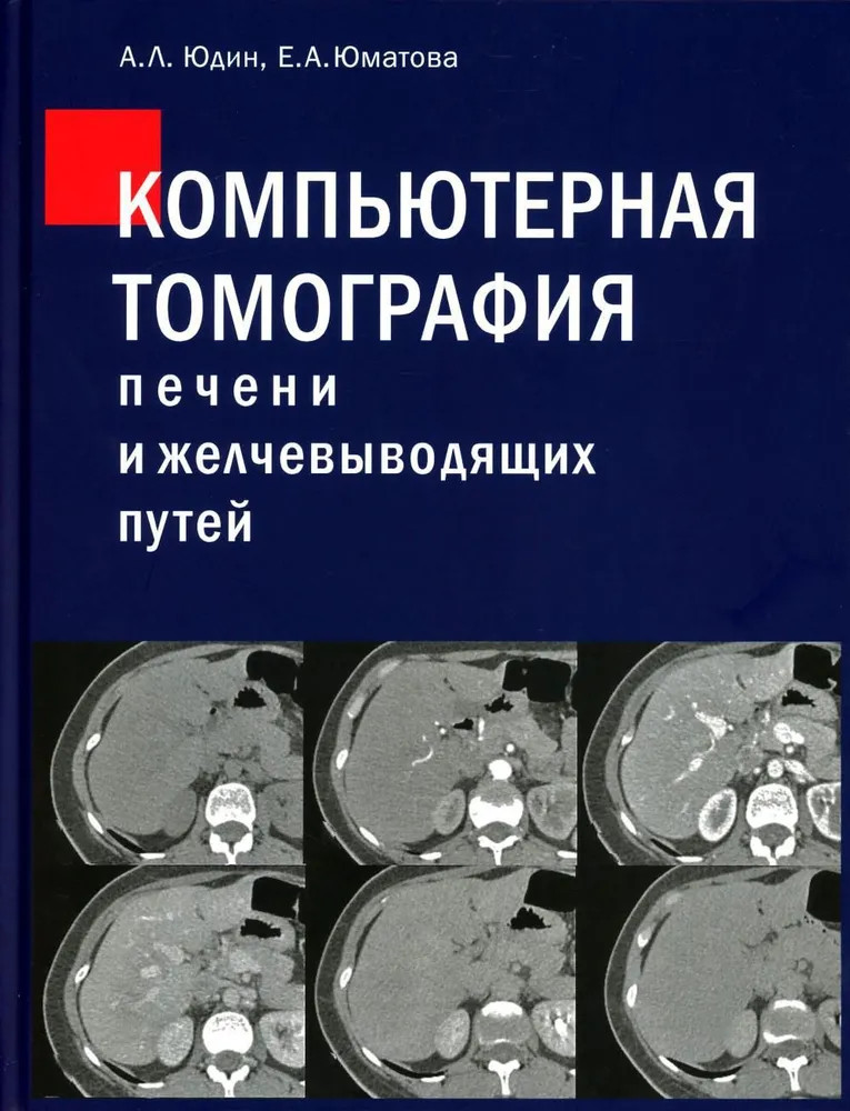 Компьютерная томография печени и желчевыводящих путей. Практическое руководство