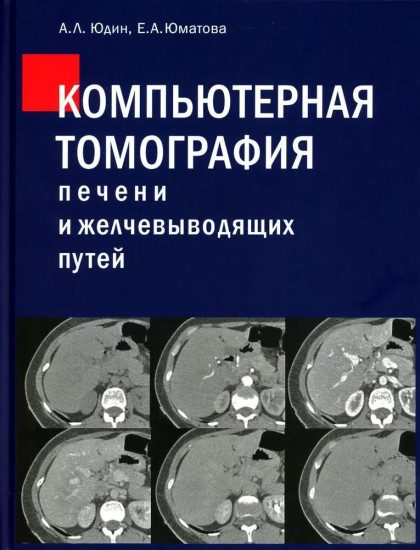 Компьютерная томография печени и желчевыводящих путей