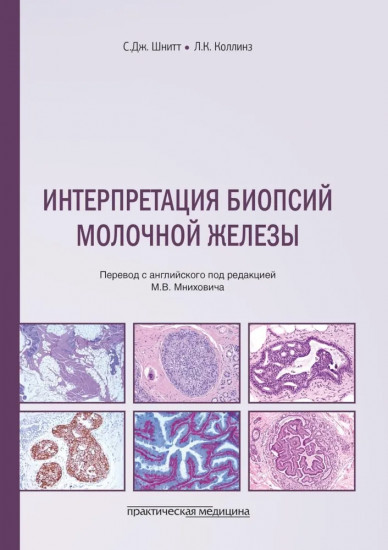 Интерпретация биопсий молочной железы