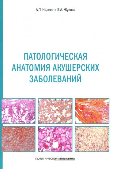 Патологическая анатомия акушерских заболеваний