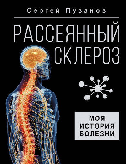 Рассеянный склероз