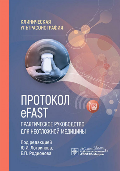 Протокол eFAST