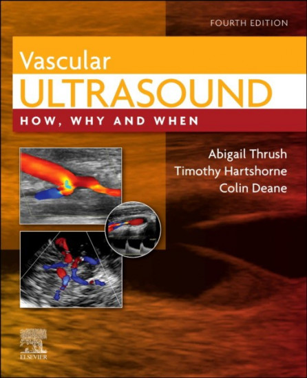 Vascular Ultrasound. How, Why and When