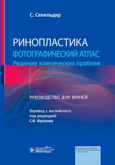 Ринопластика