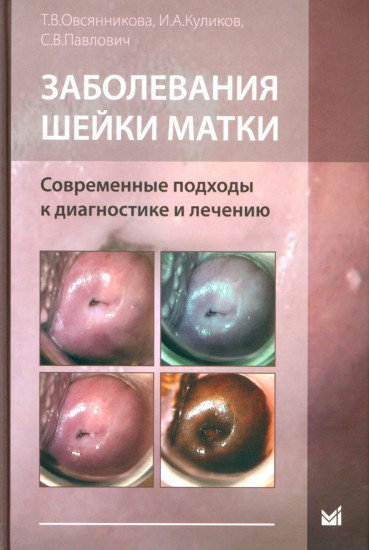 Заболевания шейки матки
