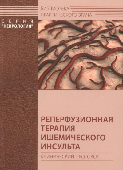 Реперфузионная терапия ишемического инсульта