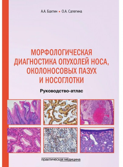 Морфологическая диагностика опухолей носа