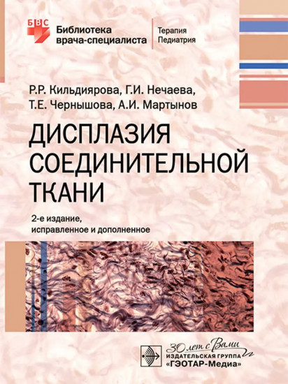 Дисплазия соединительной ткани