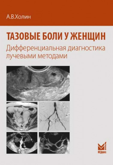 Тазовые боли у женщин. Дифференцианальная диагностика