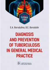 Diagnosis and prevention of tuberculosis in general medical practice: tutorial guide
