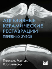 Адгезивные керамические реставрации передних зубов