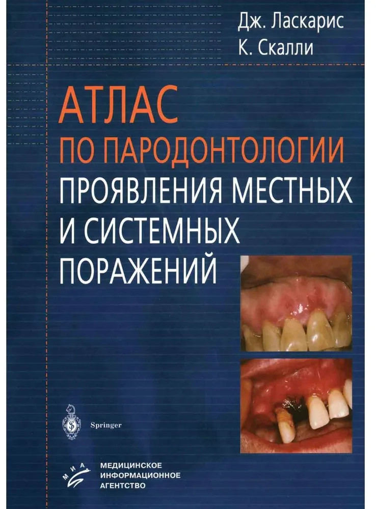 Атлас по пародонтологии. Проявления местных и системных поражений