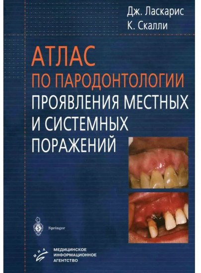 Атлас по пародонтологии. Проявления