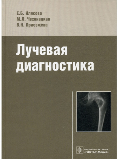 Лучевая диагностика