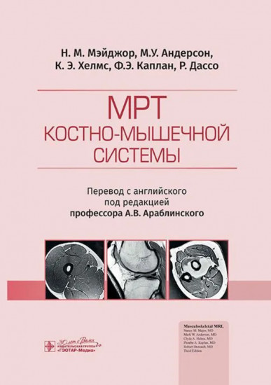 МРТ костно-мышечной системы