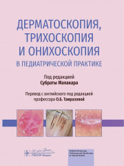 Дерматоскопия, трихоскопия и онихоскопия в педиатрической практике