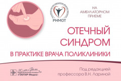 Отечный синдром в практике врача поликлиники