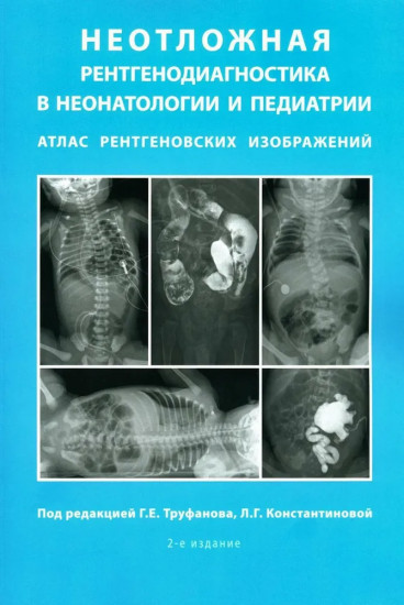Неотложная рентгенодиагностика в неонатологии и педиатрии