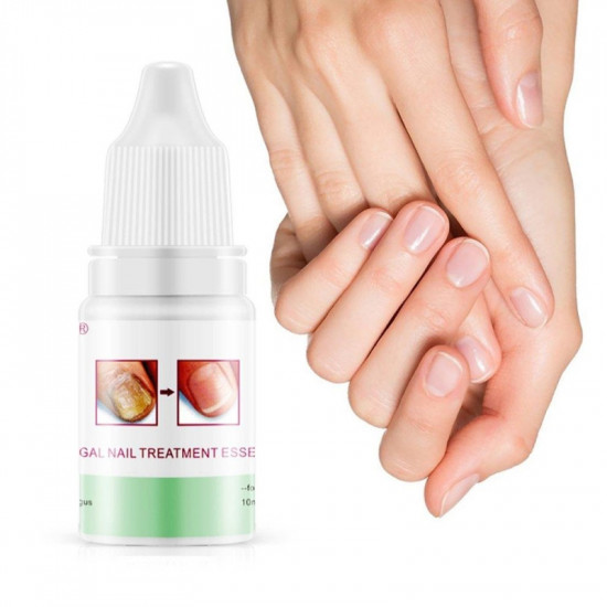 Восстанавливающий крем для ногтей «Fungal Nails Treatment»