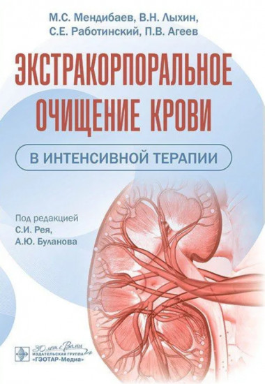 Экстракорпоральное очищение крови в интенсивной терапии