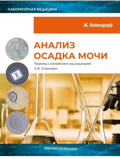 Анализ осадка мочи